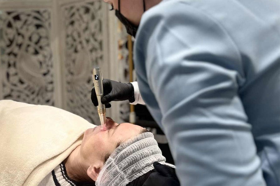 Mezoterapia / Dermapen