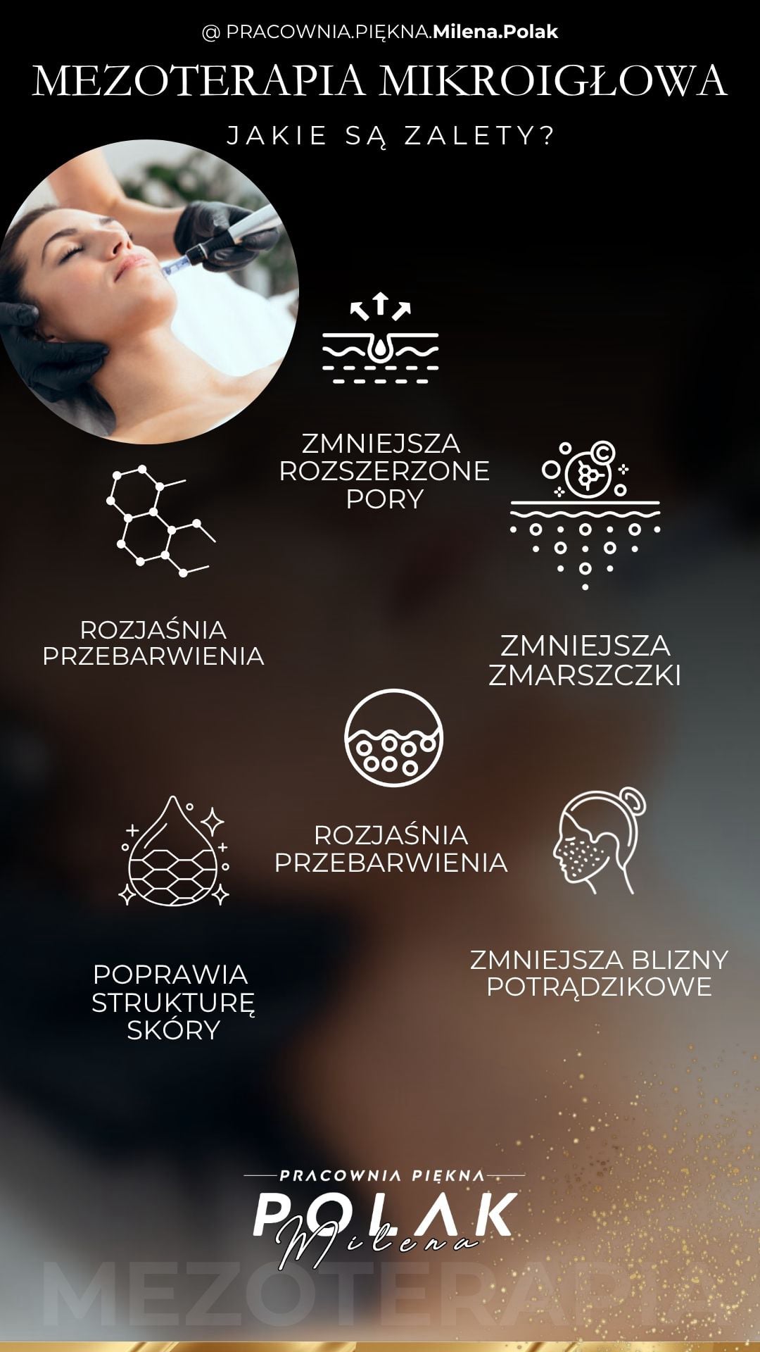 Zalety